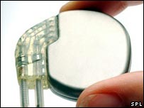 In The Future: Battery Free Pacemakers pacemaker