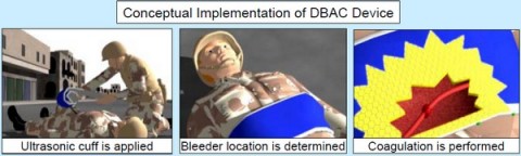darpa-bleeder-cuff-600-480x144