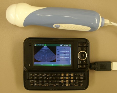 cellphone ultrasound 480x382