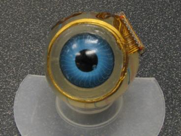 retinal_implant_2 retinal implant 2
