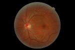 Eye Robot: Teeny Robot Swims Through Eyes, Delivers Treatments