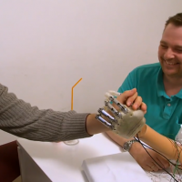 Bionic hand restores amputee’s sense of touch