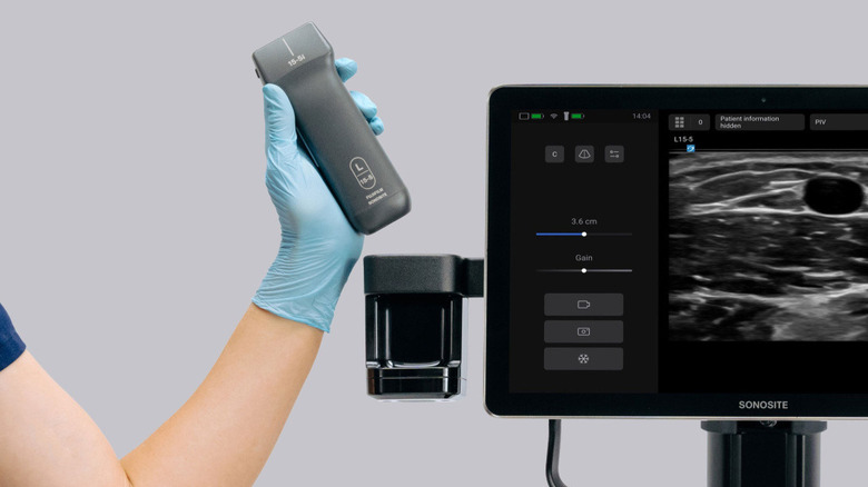 close-up of a latex-gloved hand holding a Sonosite iLook transducer in front of the ultrasound screen