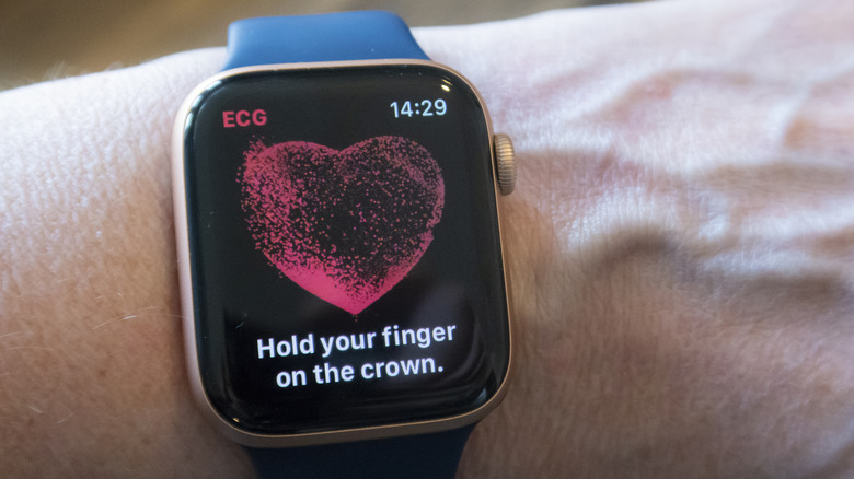 An Apple Watch on a person's wrist displaying the ECG screen