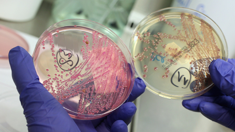 E. Coli growing in petri dish