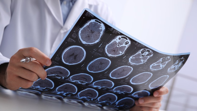 Physician examining brain scans