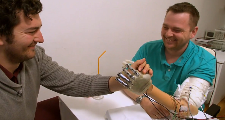 bionic_hand