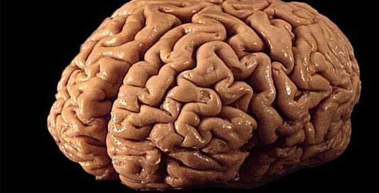 brain1