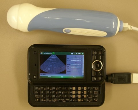 cellphone_ultrasound