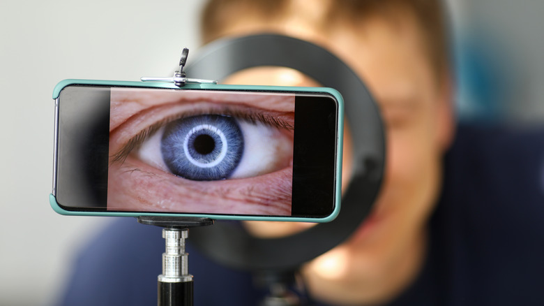 A close up photo of an eye using an external light source instead of the flash