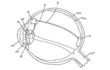 eye implantable camera