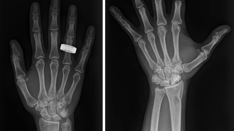 x-ray of a hand from space