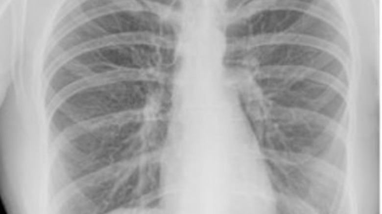 chest x-rays taken in space
