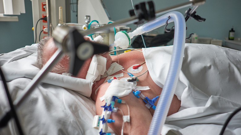 Man under ventilator in ICU