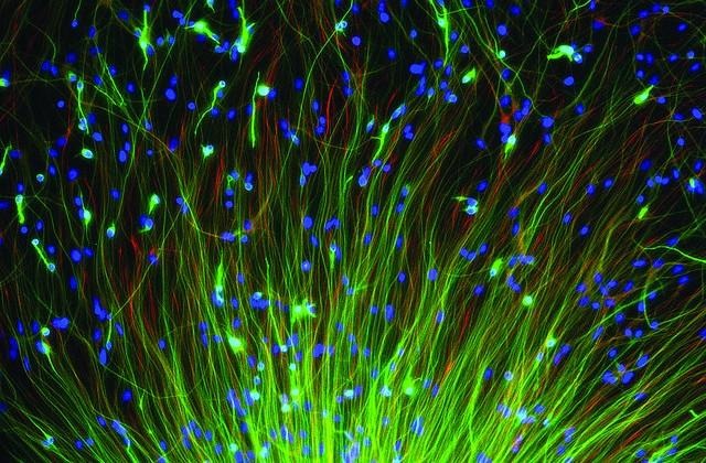 stem-brain-cells