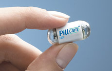 PillCam ESO 2