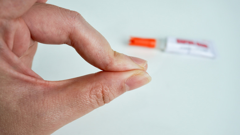 Fingers stuck together with a tube of glue in the background