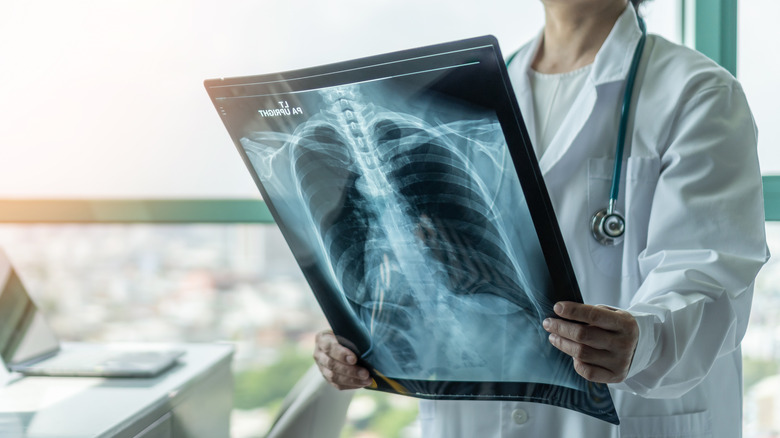 Medical professional looking at chest x-ray