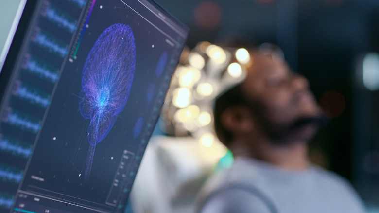 EEG of brain activity