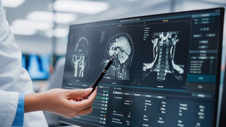 Brain scan doctor
