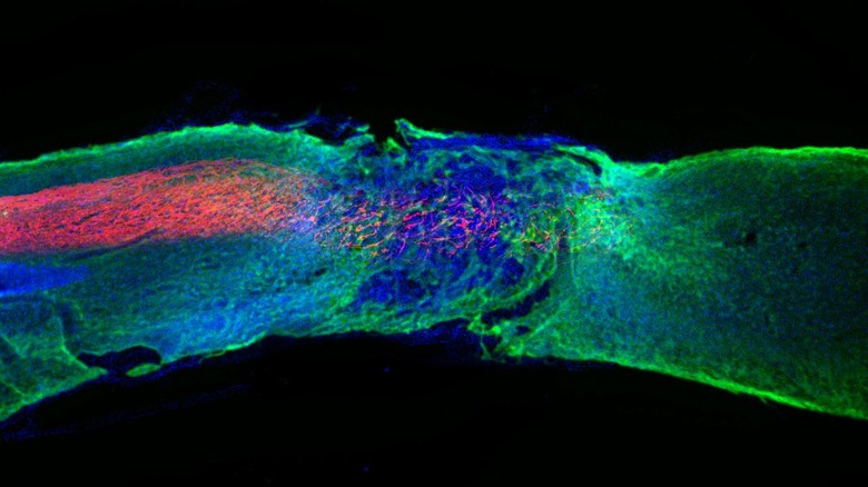Medical imaging of spinal cord section