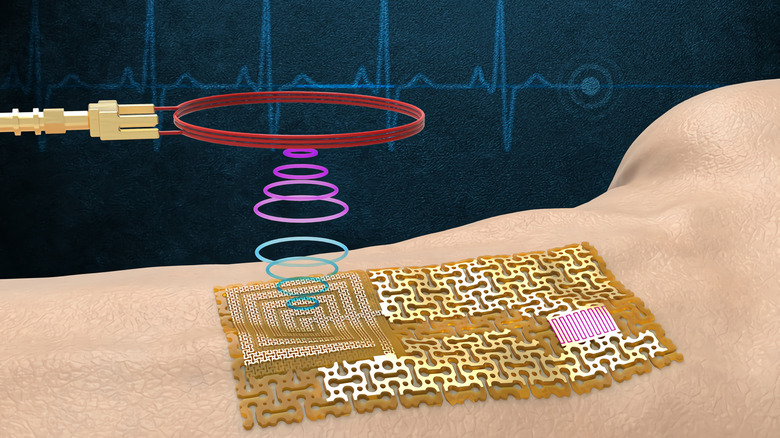An electronic skin patch with piezoelectric sensors