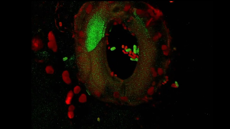 Stomata open after bacterial infection.