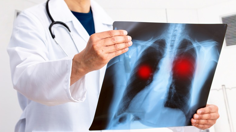 DR looking at chest xray