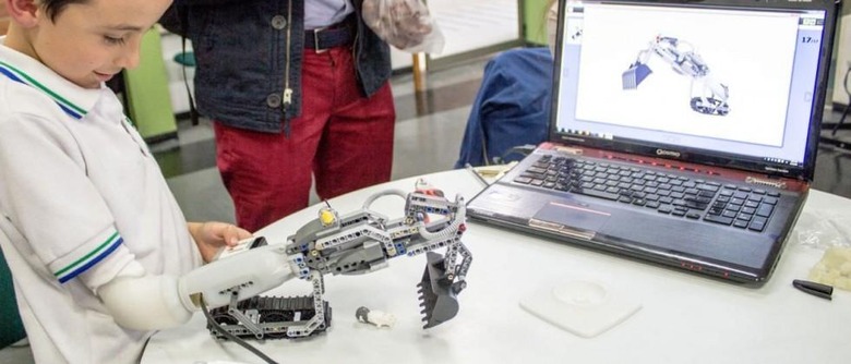 This prosthetic arm is expandable with Lego