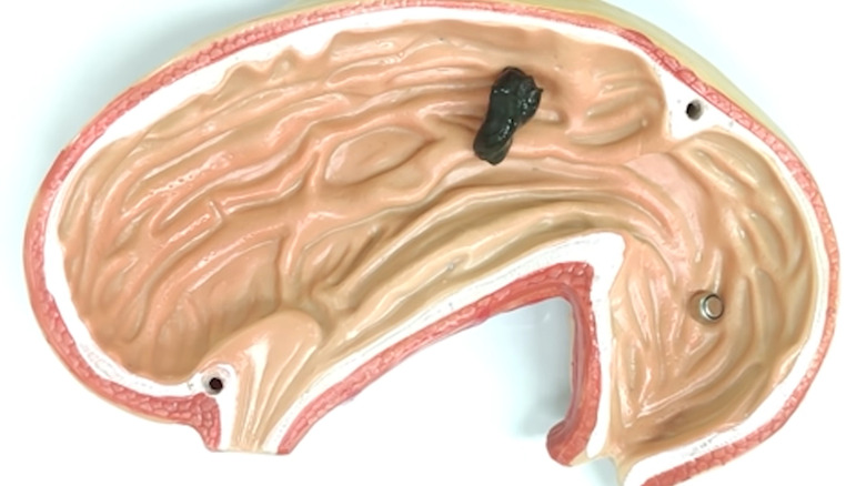 Robotic slime traveling through plastic intestine