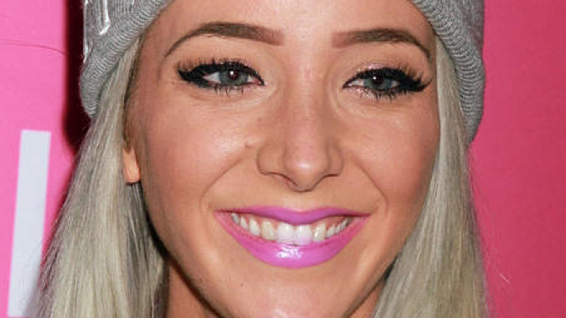 Jenna Marbles Nose Scar