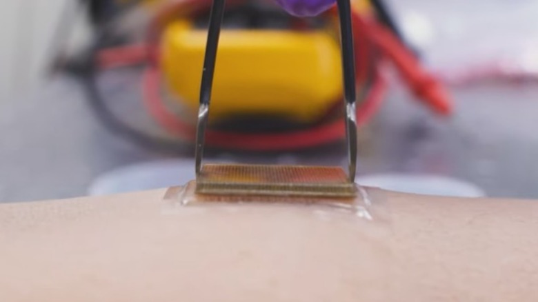 Attaching an ultrasound sticker to skin.