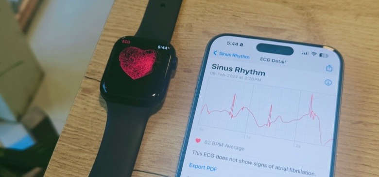 Sistema de ECG en Apple Watch