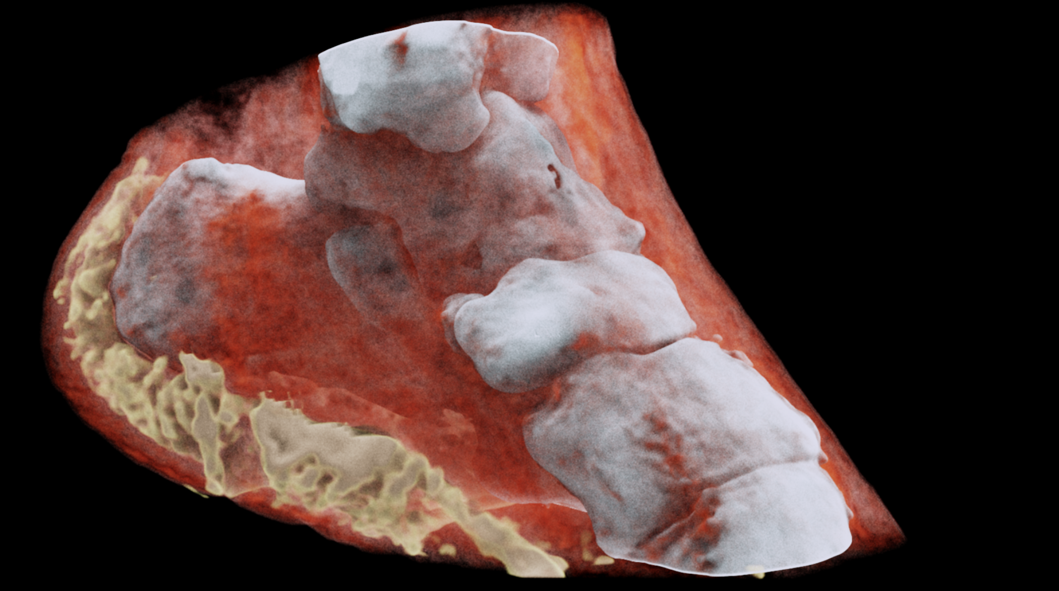 Behold, 3D Color X-Rays: MARS Scanner, Made With CERN Tech - SlashGear