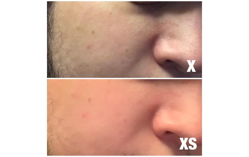 iPhone XS aggressive “beauty filter” might just be a bug