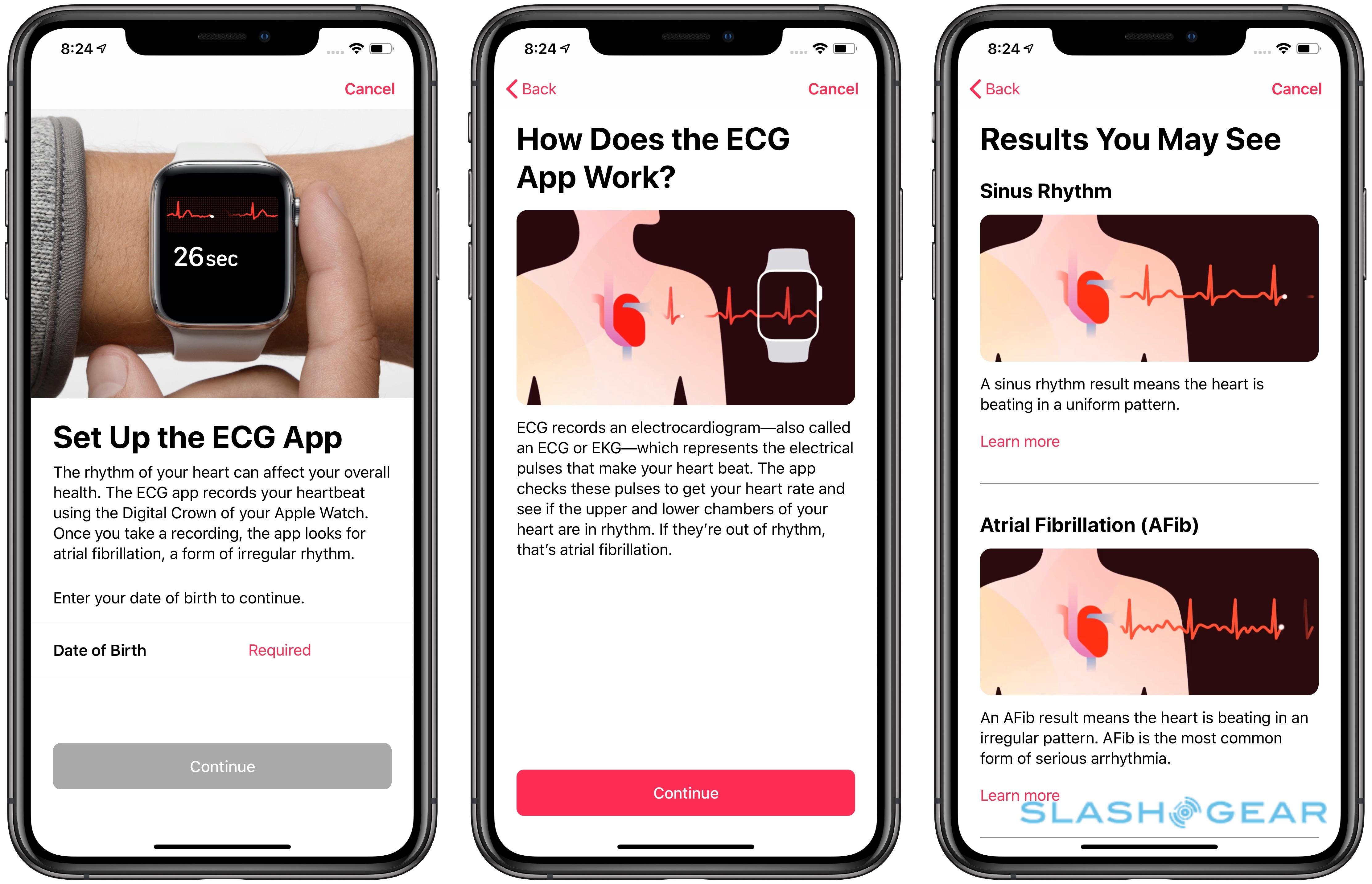 apple ecg release date