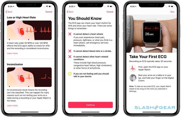 new apple watch ekg app