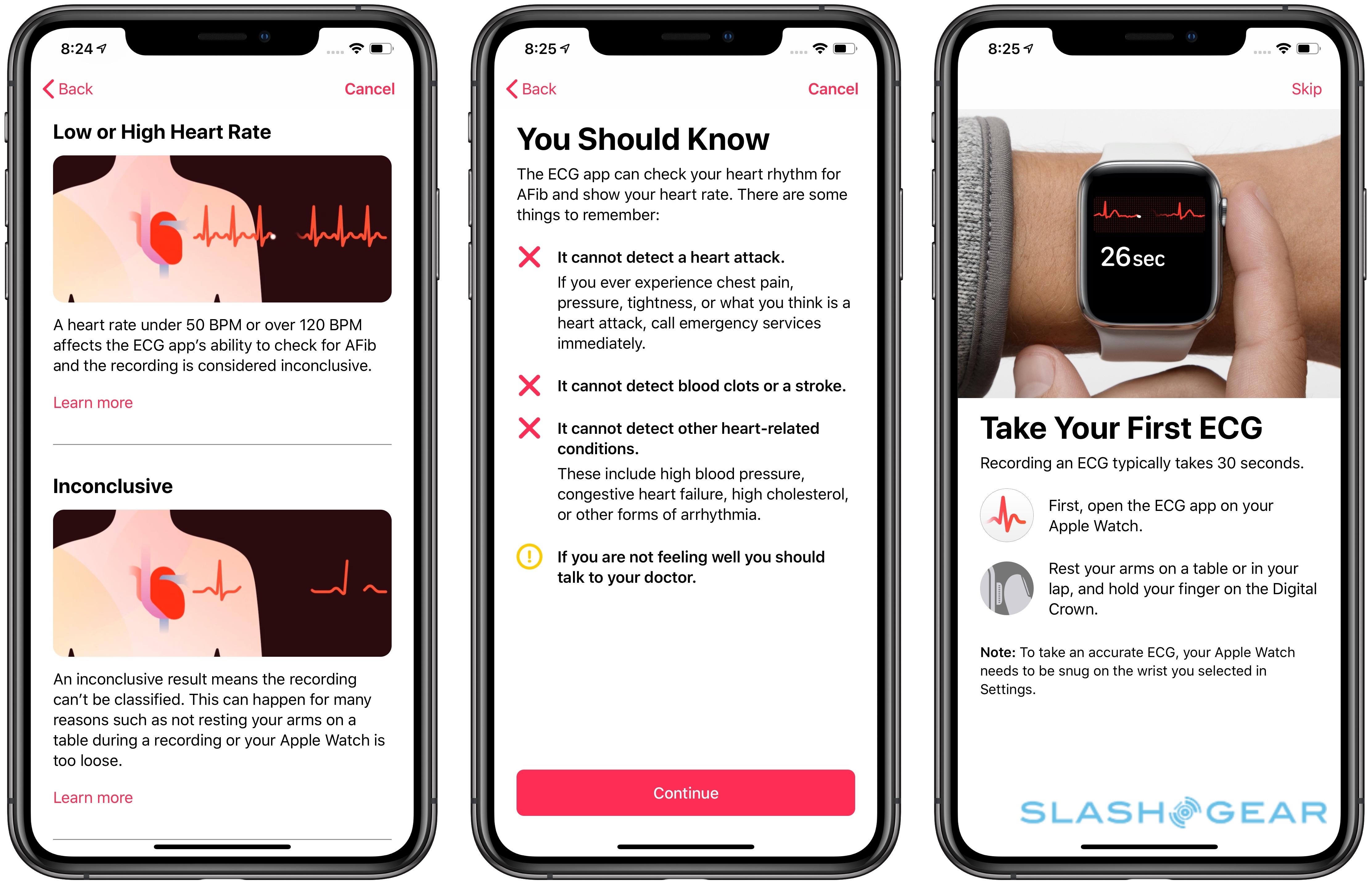 ECG watch 7 приложение. Heart rate ECG часы. Apple watch Heart rate. Приложение Heartify.