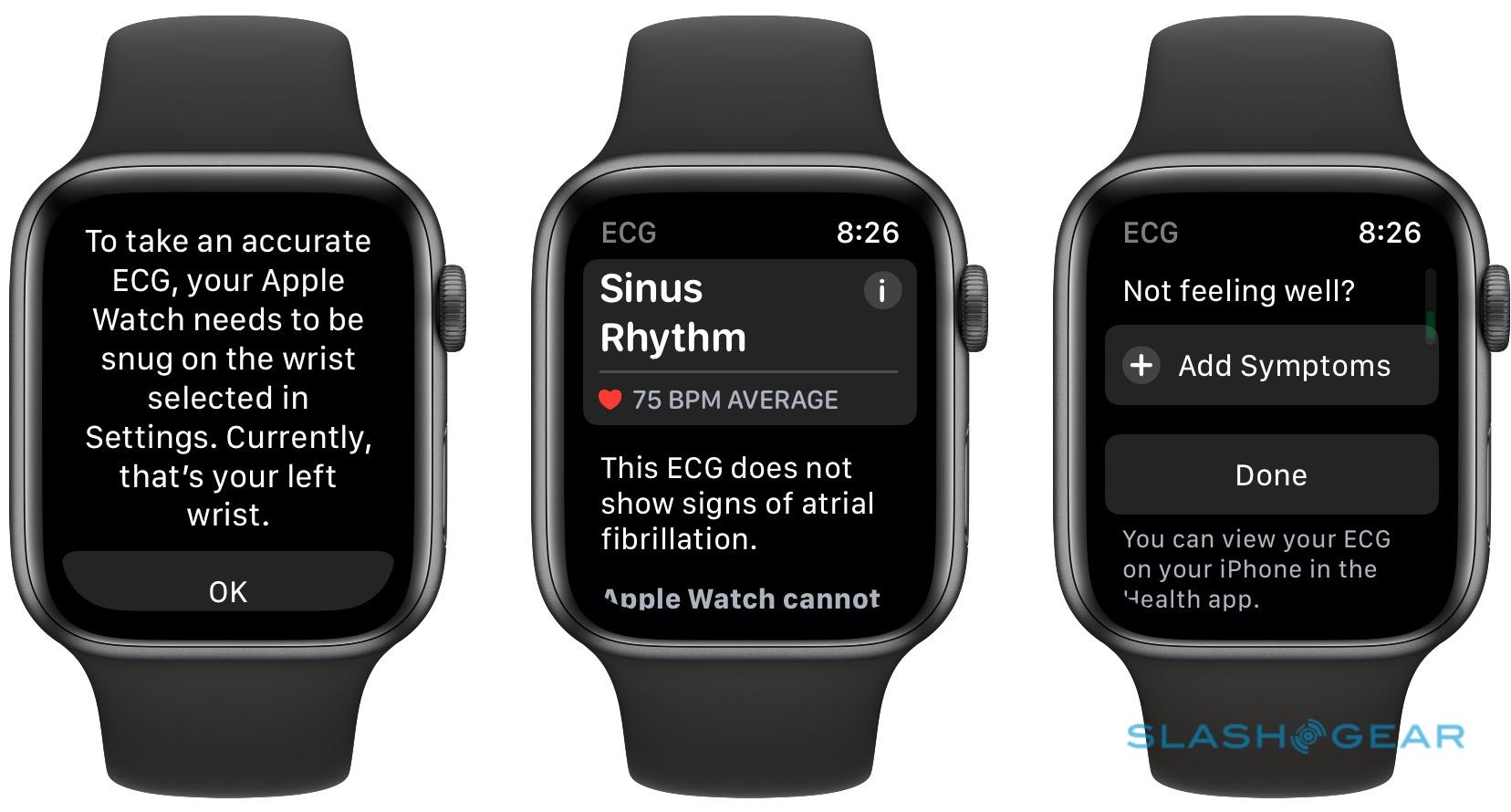 ekg app iwatch