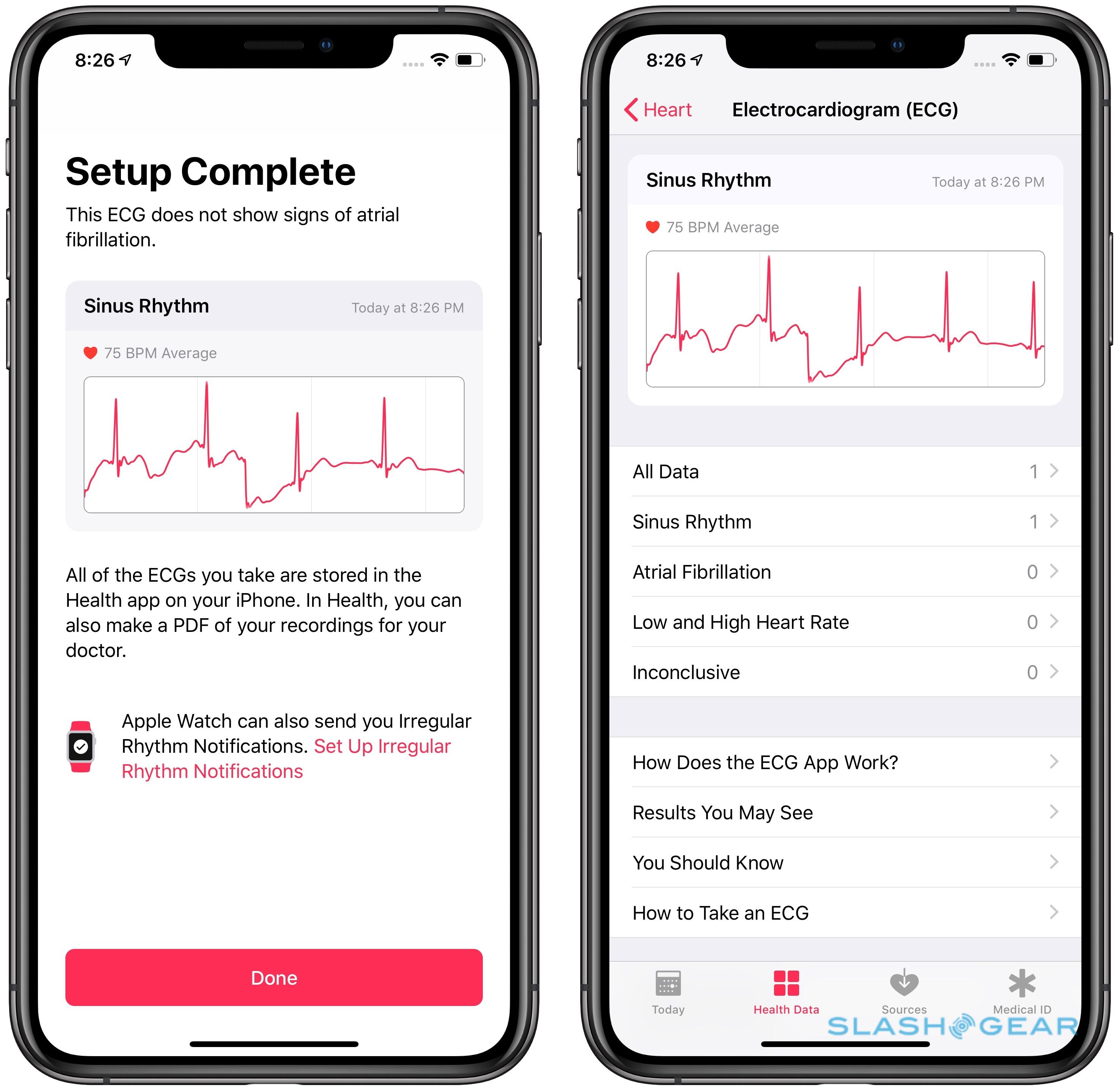 ecg not in health app