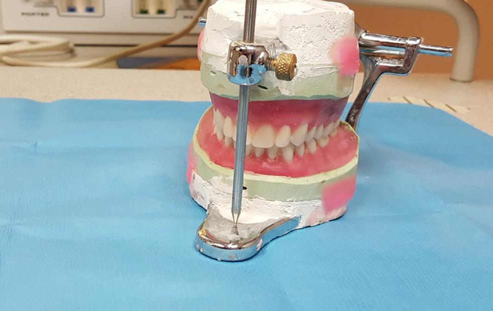 Texas starts using 3D-printers to create dentures for prisoners