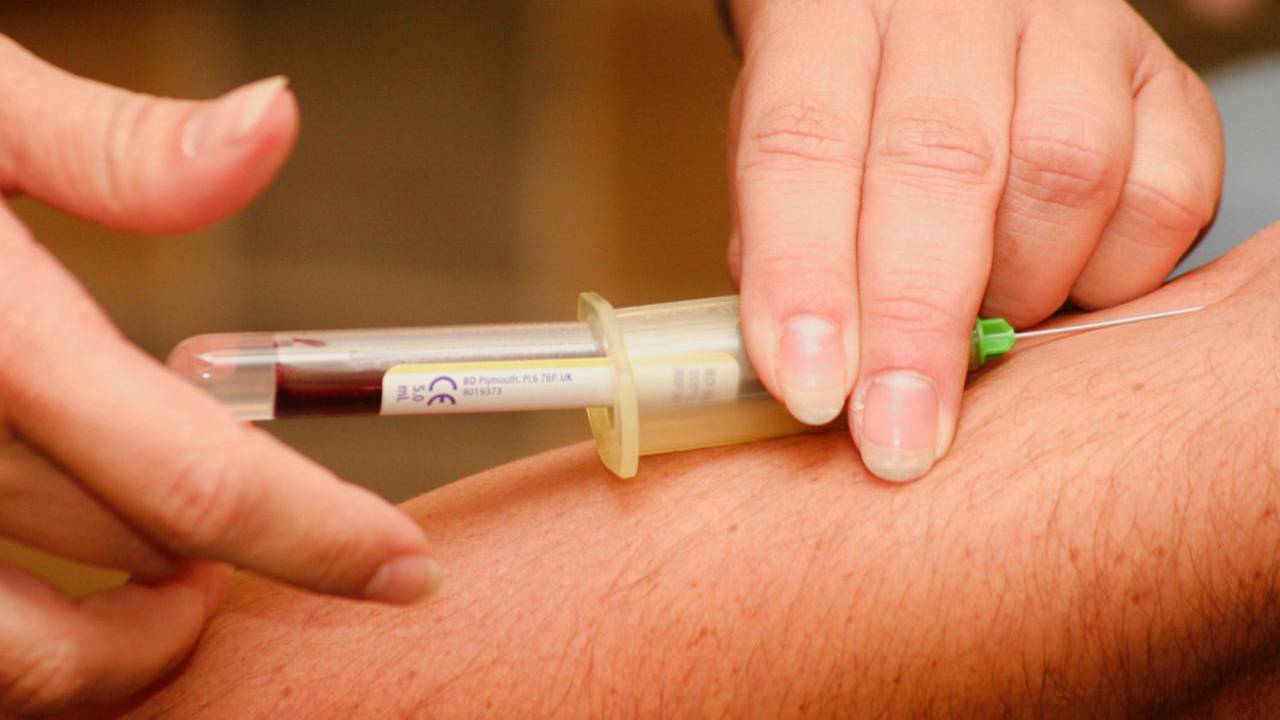 Alzheimer’s blood test optimized to detect disease before symptoms