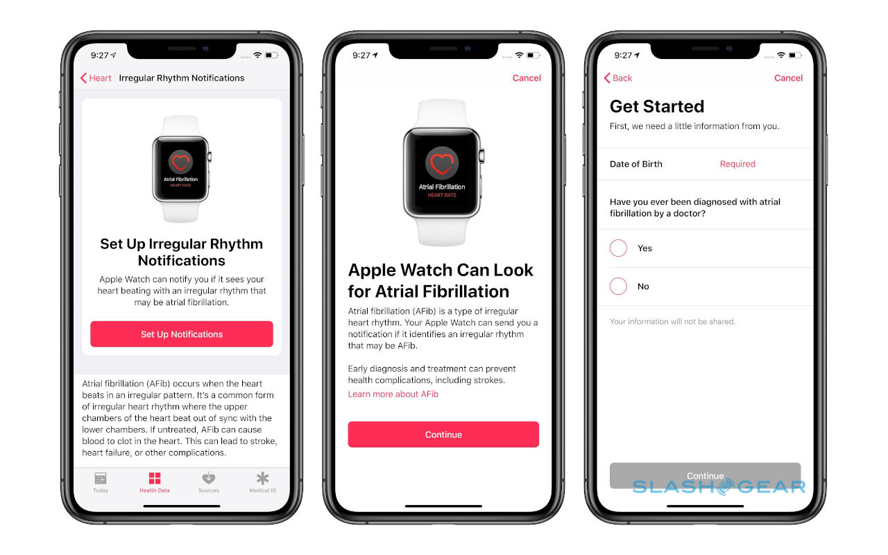 apple watch series 4 atrial fibrillation