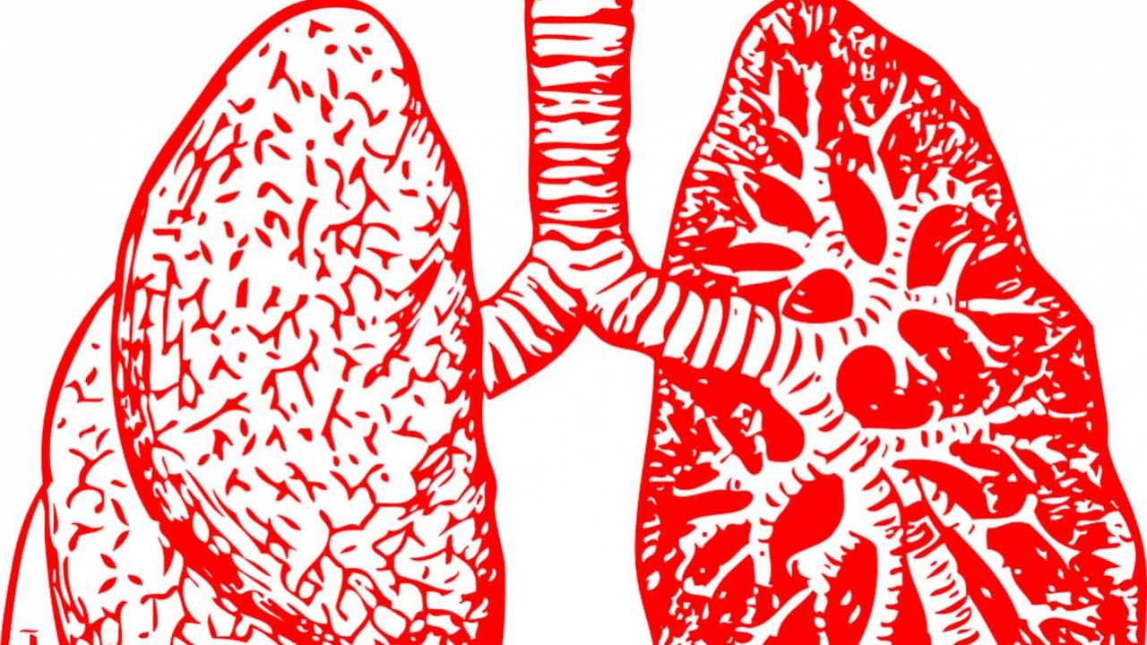 Vaping may cause lung scarring commonly found in metal workers