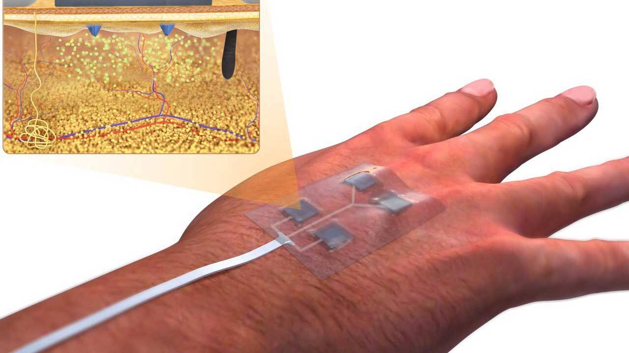 UConn researchers design new wireless smart-bandage to heal wounds