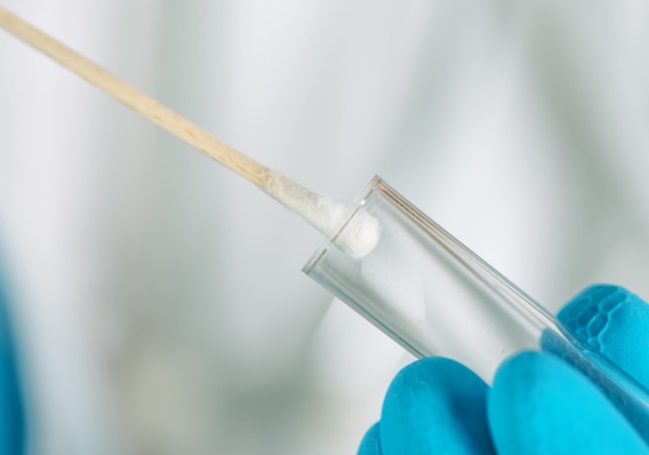 First athome coronavirus test sampling kit gets FDA goahead SlashGear