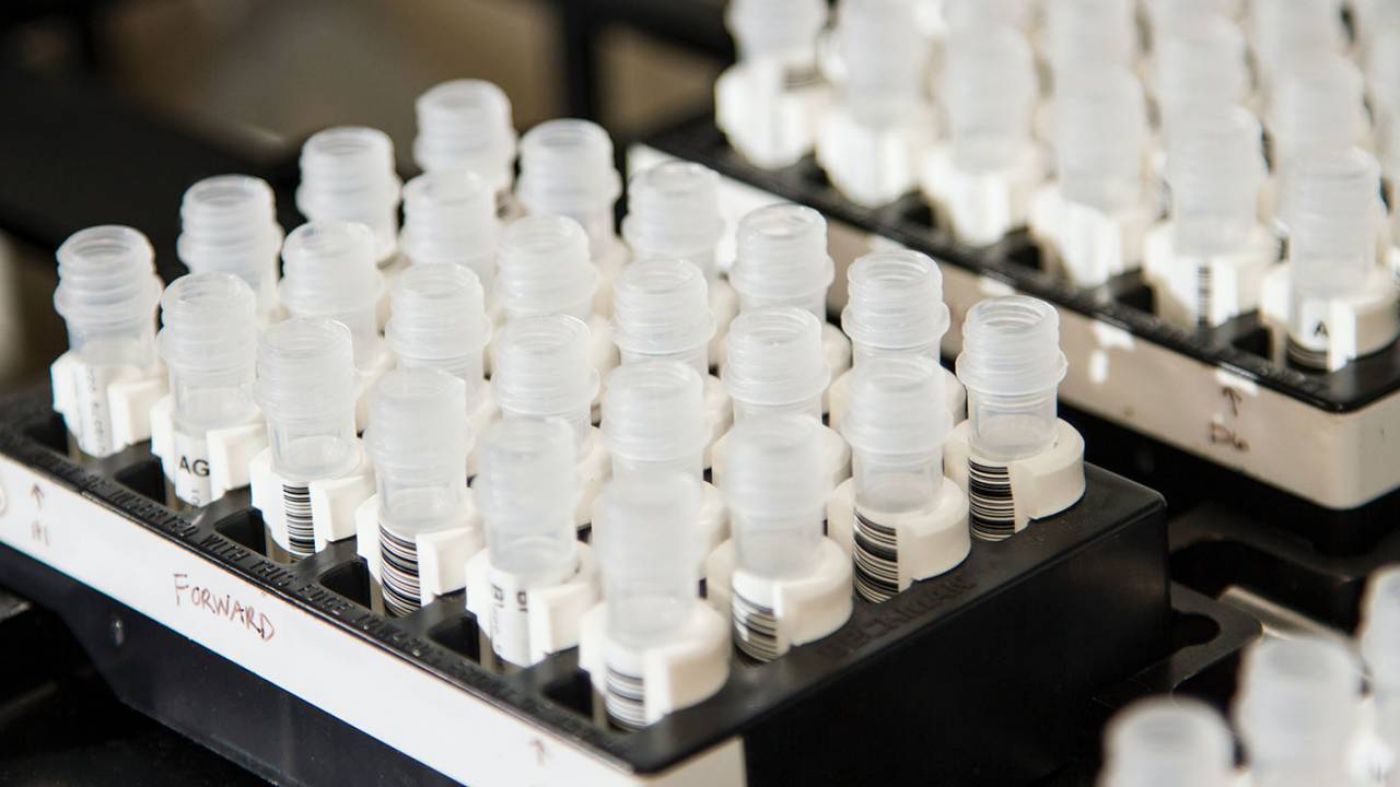 Breast cancer ‘switch’ found to turn off aggressive growth and spread