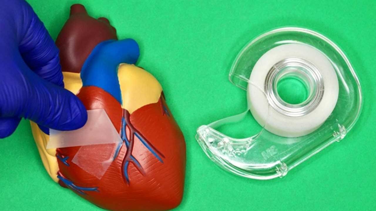 MIT surgical adhesive detaches on demand