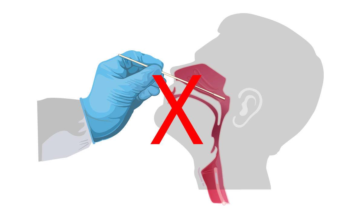 Yale saliva-based COVID-19 test gets FDA emergency use approval