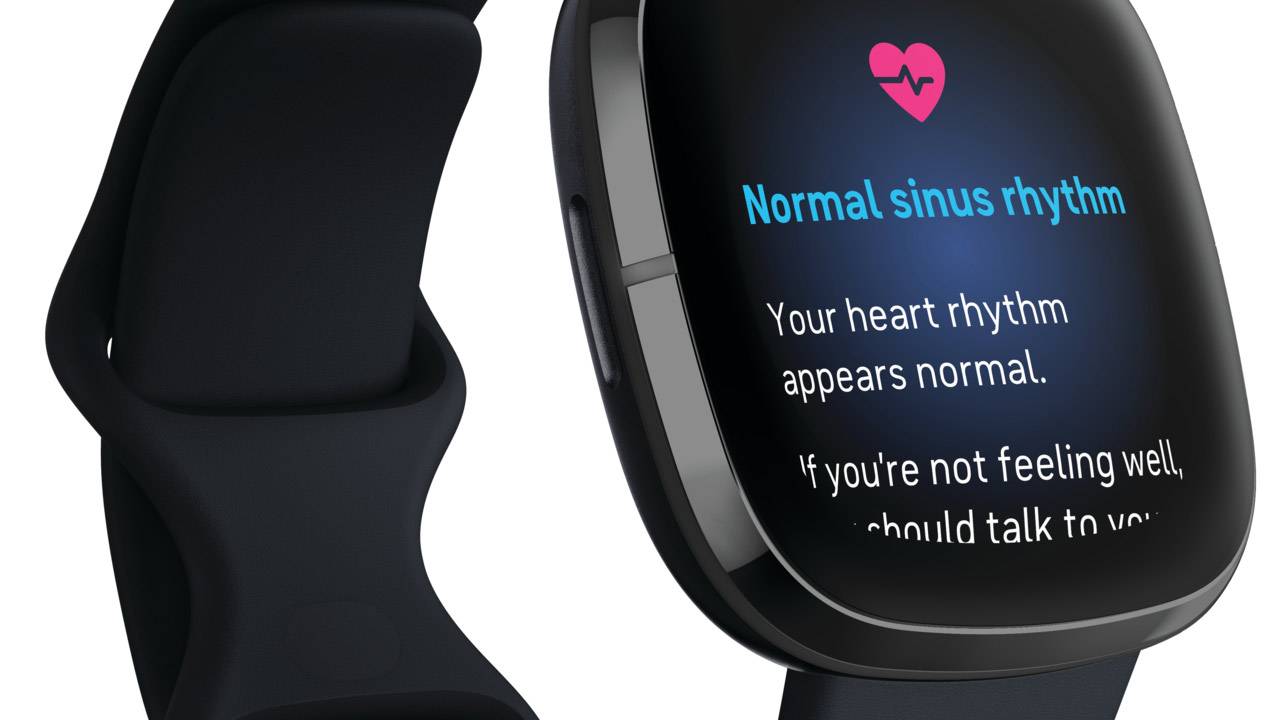 ecg watch fitbit